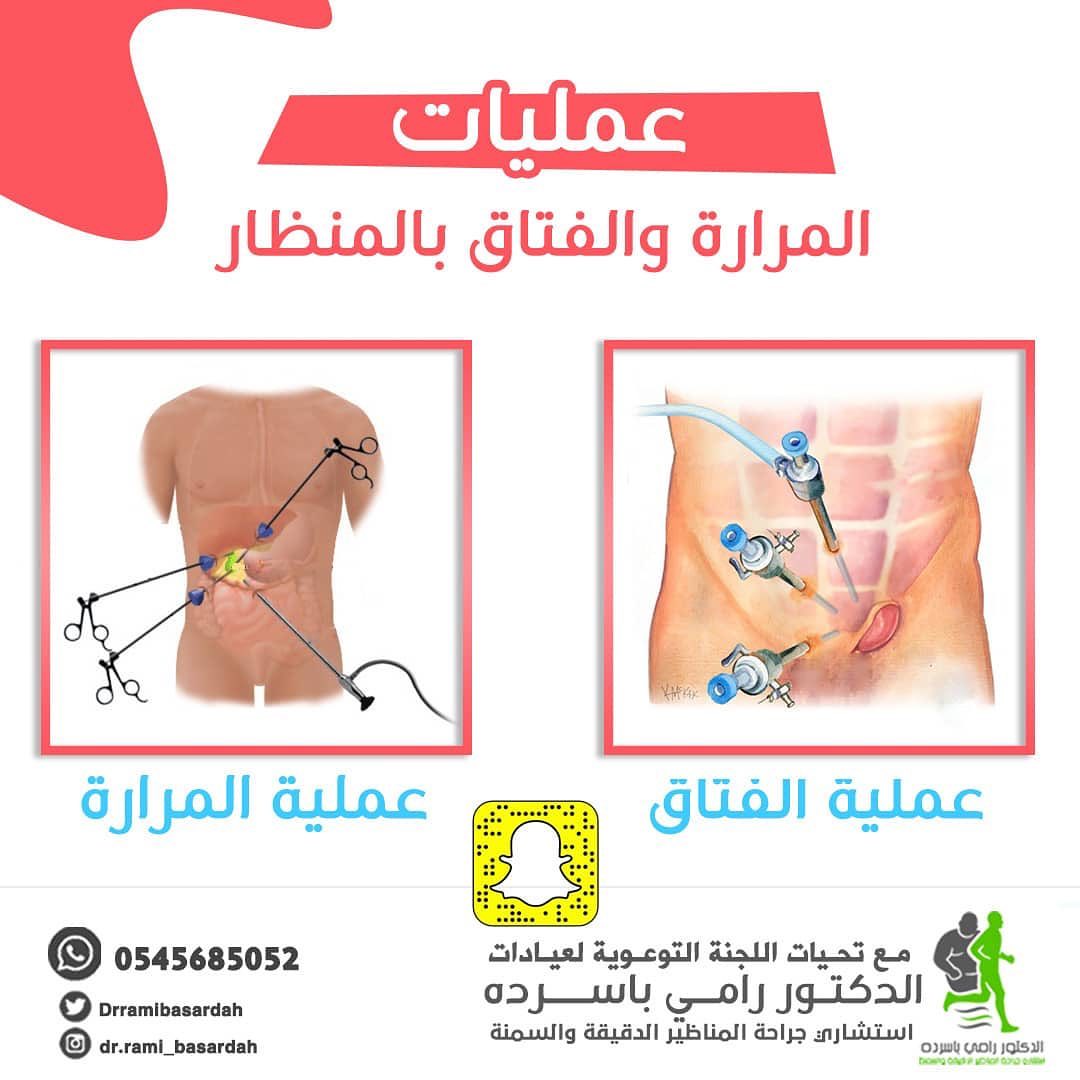 اجراء جميع عمليات السمنه والجراحه العامه في عيادات الدكتور رامي باسرده استشاري جراحة السمن