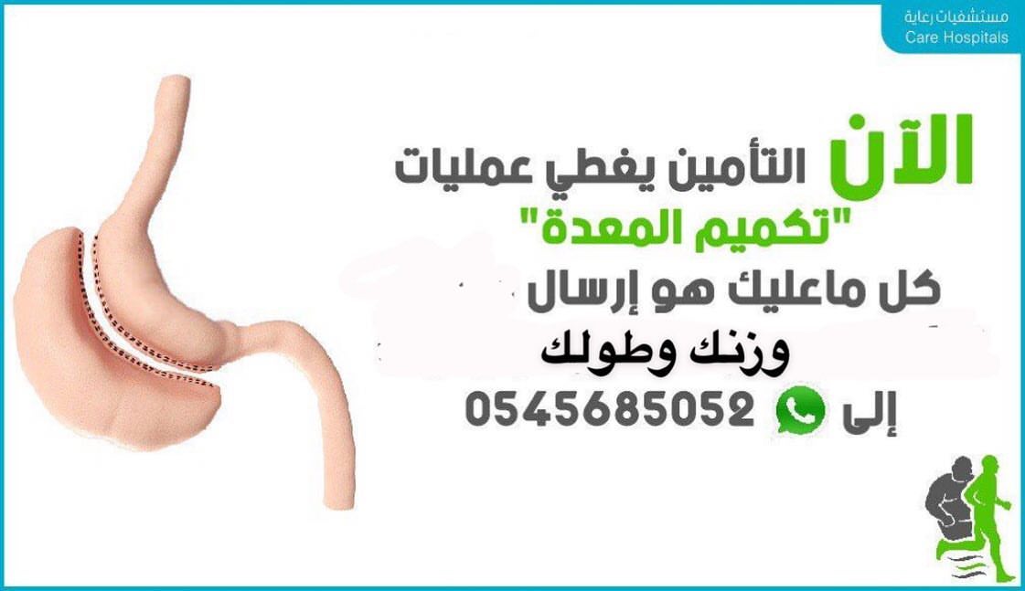#عمليات #السمنه على #التأمين #التامينات #التأمين_الصحي #بوبا #التعاونيه #تكافل #تكميم #تجم