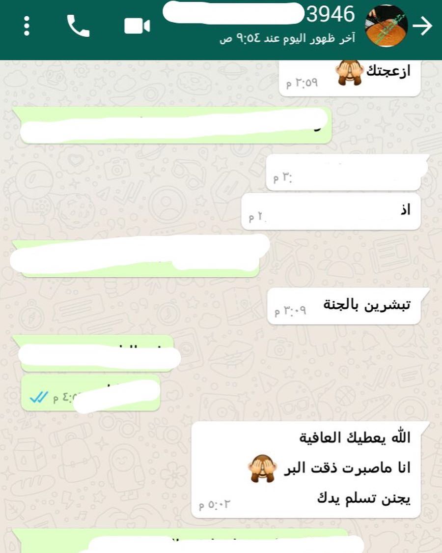آراء زباينا