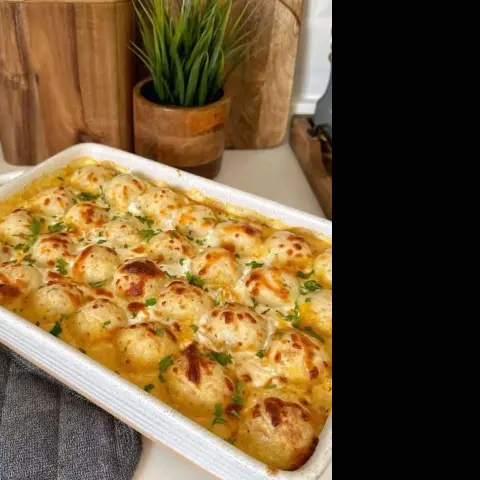 كرات البطاطس 😍 السعر على حسب الطلب ❤️